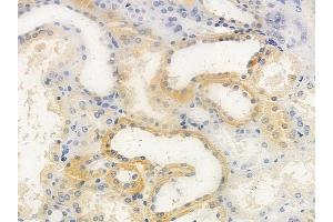 ABIN6259401 and ABIN6276171 at 1/100 staining human normal kidney tissue by IHC-P.