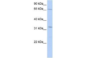 WB Suggested Anti-TRIM22 Antibody Titration:  0. (TRIM22 anticorps  (Middle Region))