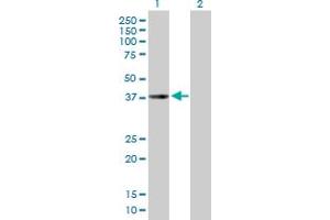 Western Blot analysis of CHI3L2 expression in transfected 293T cell line by CHI3L2 MaxPab polyclonal antibody. (CHI3L2 anticorps  (AA 1-390))