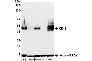 Western Blotting (WB) image for anti-CD48 (CD48) (AA 29-220) antibody (ABIN7795688) (Recombinant CD48 anticorps  (AA 29-220))