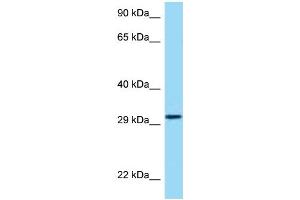 WB Suggested Anti-HRH4 Antibody Titration: 1. (HRH4 anticorps  (Middle Region))