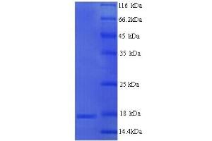 SDS-PAGE (SDS) image for Myelin Protein Zero (MPZ) (AA 30-156), (partial) protein (His tag) (ABIN5713664)