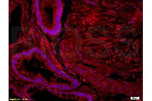 Formalin-fixed and paraffin embedded human placenta tissue labeled with  (ABIN725960)  Rabbit Anti-Nociceptin receptor Polyclonal Antibody at 1: 200 followed by incubation with conjugated secondary antibody and DAB staining. (OPRL1 anticorps  (AA 1-47))