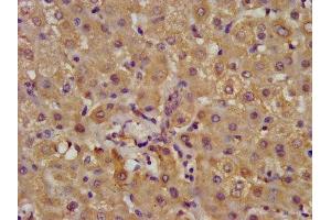 IHC image of ABIN7143836 diluted at 1:400 and staining in paraffin-embedded human liver tissue performed on a Leica BondTM system.