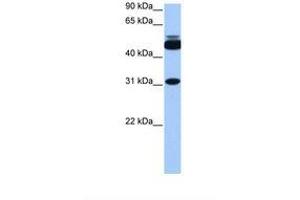 Image no. 1 for anti-Cylicin, Basic Protein of Sperm Head Cytoskeleton 2 (CYLC2) (C-Term) antibody (ABIN6738858) (CYLC2 anticorps  (C-Term))