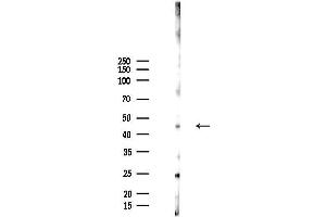 anti-Exosome Component 9 (EXOSC9) antibody