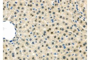ABIN6263252 and ABIN6279536 at 1/100 staining Rat liver tissue by IHC-P. (m1ip1 anticorps  (Internal Region))