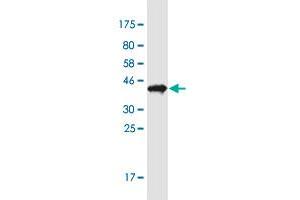 Western Blot detection against Immunogen (37.