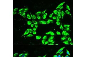 Immunofluorescence analysis of A549 cells using KLK10 Polyclonal Antibody
