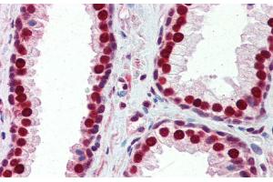 Immunohistochemistry with Human Prostate lysate tissue at an antibody concentration of 5.