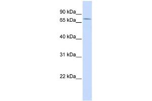 WB Suggested Anti-ZNF442 Antibody Titration: 0. (ZNF442 anticorps  (Middle Region))