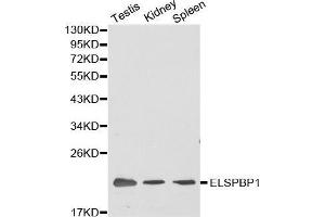 Western blot analysis of extracts of various cell lines, using ELSPBP1 antibody. (ELSPBP1 anticorps  (AA 1-223))