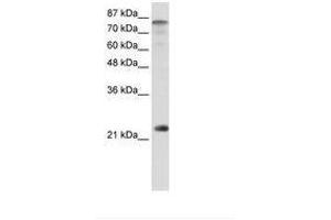 Image no. 1 for anti-Nuclear Transcription Factor Y, beta (NFYB) (N-Term) antibody (ABIN6736220) (NFYB anticorps  (N-Term))