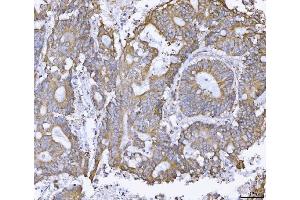 IHC analysis of ATX2/ATXN2 using anti-ATX2/ATXN2 antibody (ABIN3043507). (Ataxin 2 anticorps  (C-Term))