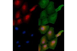 ABIN6257317 and ABIN6275836 staining  cells by IF/ICC. (MAGEC2 anticorps  (Internal Region))