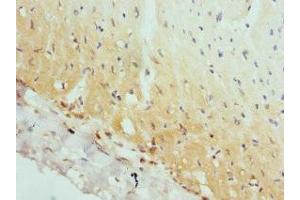 Immunohistochemistry of paraffin-embedded human heart tissue using ABIN7144362 at dilution of 1:100