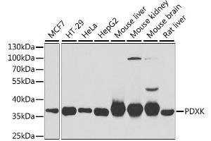 Western blot analysis of extracts of various cell lines, using PDXK antibody. (PDXK anticorps  (AA 1-312))