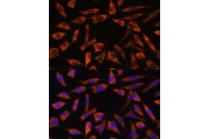 anti-Coiled-Coil-Helix-Coiled-Coil-Helix Domain Containing 2 (CHCHD2) (AA 75-145) antibody