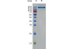 Human Protein, hFc Tag on SDS-PAGE under reducing condition.