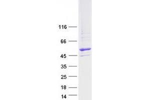 Validation with Western Blot