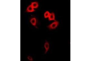 Immunofluorescent analysis of GalNAc-T2 staining in Hela cells. (GalNAc-T2 anticorps)