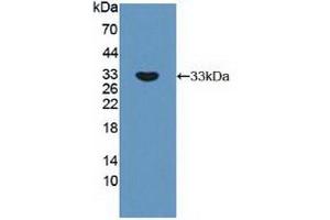 Detection of Recombinant RPS6Kb1, Human using Polyclonal Antibody to Ribosomal Protein S6 Kinase Beta 1 (RPS6Kb1)