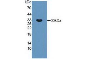 Detection of Recombinant RPS6Kb1, Human using Polyclonal Antibody to Ribosomal Protein S6 Kinase Beta 1 (RPS6Kb1) (RPS6KB1 anticorps  (AA 91-352))