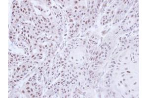 IHC-P Image Immunohistochemical analysis of paraffin-embedded Cal27 Xenograft, using PSR, antibody at 1:100 dilution.
