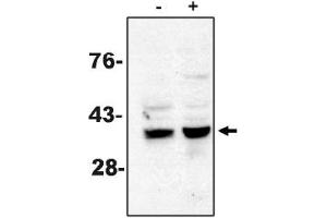 Western Blotting (WB) image for anti-Caspase 7, Apoptosis-Related Cysteine Peptidase (CASP7) antibody (ABIN264418) (Caspase 7 anticorps)