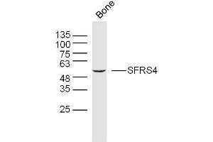 Mouse bone lysates probed with SFRS4 Polyclonal Antibody, Unconjugated  at 1:300 overnight at 4˚C. (SRSF4 anticorps  (AA 1-100))