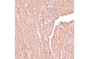 Immunohistochemistry of paraffin-embedded Mouse heart using PGD antibody (ABIN6127314, ABIN6145502, ABIN6145503 and ABIN6223639) at dilution of 1:100 (40x lens).