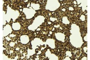 ABIN6276704 at 1/100 staining Mouse lung tissue by IHC-P.