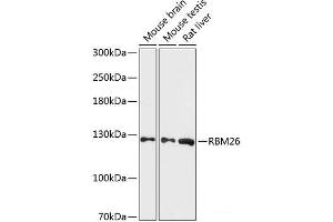 Western blot analysis of extracts of various cell lines using RBM26 Polyclonal Antibody at dilution of 1:3000. (RBM26 anticorps)
