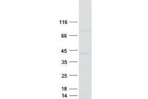 Validation with Western Blot
