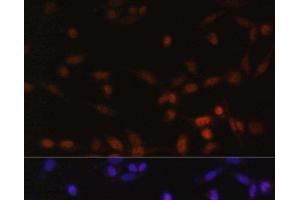 Immunofluorescence analysis of NIH/3T3 cells using ZEB2 Polyclonal Antibody at dilution of 1:100. (ZEB2 anticorps)