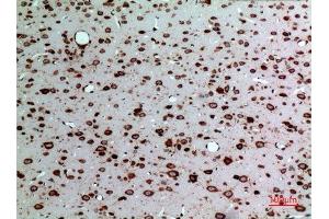 Immunohistochemistry (IHC) analysis of paraffin-embedded Rat Brain, antibody was diluted at 1:100. (Midkine anticorps  (Internal Region))