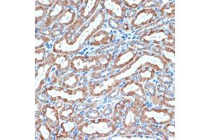 Immunohistochemistry of paraffin-embedded mouse kidney using DCR2 Rabbit mAb (ABIN7271063) at dilution of 1:100 (40x lens).