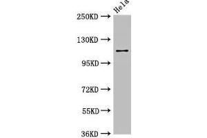Western Blot Positive WB detected in: Hela whole cell lysate All lanes: SEC23IP antibody at 2. (SEC23IP anticorps  (AA 779-989))
