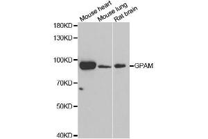 Western blot analysis of extracts of various cell lines, using GPAM antibody. (GPAM anticorps  (AA 594-828))