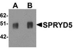Western blot analysis of SPRYD5 in rat brain tissue lysate with SPRYD5 antibody at (A) 0. (TRIM51 anticorps  (C-Term))