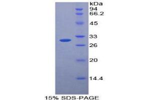 SDS-PAGE analysis of Mouse Protease, Serine 12 Protein. (Protease Protéine)
