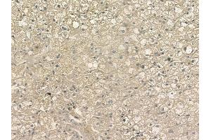 ABIN6255414 and ABIN6267211 at 1/100 staining human normal liver tissue by IHC-P.