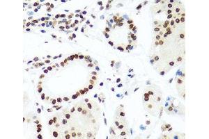 Immunohistochemistry of paraffin-embedded Human stomach using Histone H2AX Polyclonal Antibody at dilution of 1:100 (40x lens). (H2AFX anticorps)