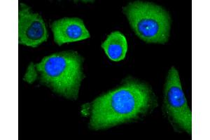 A549 cells were stained with HDAC4 (6B10) Monoclonal Antibody  at [1:200] incubated overnight at 4C, followed by secondary antibody incubation, DAPI staining of the nuclei and detection.