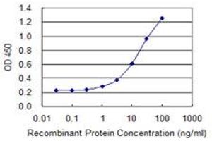 Detection limit for recombinant GST tagged SLC39A10 is 0.