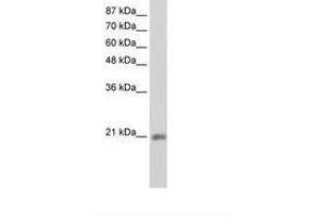 anti-MIF4G Domain Containing (MIF4GD) (C-Term) antibody