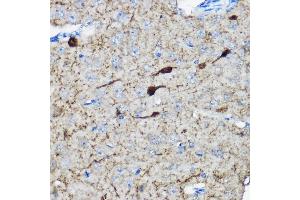 Immunohistochemistry of paraffin-embedded mouse brain using Calretinin Rabbit pAb (ABIN6129247, ABIN6137849, ABIN6137850 and ABIN6225108) at dilution of 1:100 (40x lens). (Calretinin anticorps  (AA 1-271))