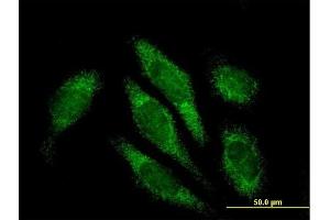 Immunofluorescence of purified MaxPab antibody to ALDH16A1 on HeLa cell.
