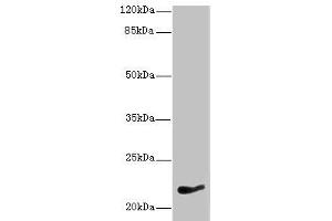 Western blot All lanes: NKIRAS1 antibody at 7 μg/mL + HepG2 whole cell lysate Secondary Goat polyclonal to rabbit IgG at 1/10000 dilution Predicted band size: 22 kDa Observed band size: 22 kDa (NKIRAS1 anticorps  (AA 1-192))