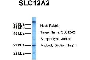 Host: Rabbit Target Name: SLC12A2 Sample Tissue: Human Jurkat Antibody Dilution: 1.